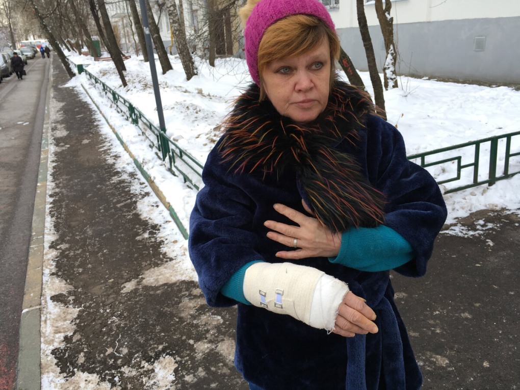 Зимняя одежда со сломанной рукой